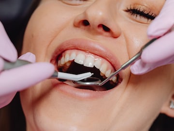 अक्कलदाढ येताना असह्य वेदना का होतात? शरीरात या दाढेचं काम तरी काय? जाणून घ्या