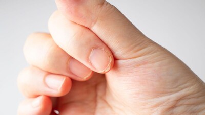 Nails: A Mirror to Your Health – Key Insights into Nail Care and What They Reveal