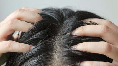 Sticky Hair & Scalp? Grandma's Remedies to the Rescue for October Heat Hair Woes!