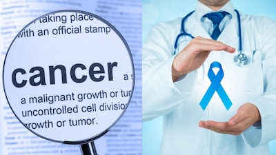 Cancer Risk: 5 Unhealthy Habits Fueling Cancer, Doctors Warn - Be Cautious!