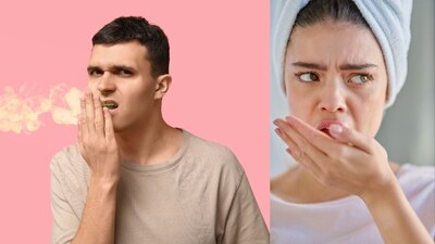 Bad Breath Causes and Remedies: What Your Mouth Is Telling You