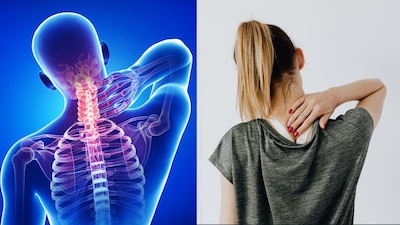 Neck Pain From Laptop Use? Try These Simple Exercises For Relief