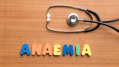 Anemia Signs: Identify Iron Deficiency And Health Issues Through Your Nails