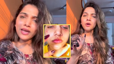 Janhavi Killekar Slams Trolls Over Kolhapur Water Controversy, Shares Shocking Skin Infection Photos