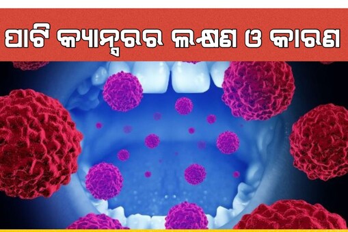ପାଟି କ୍ୟାନ୍ସର