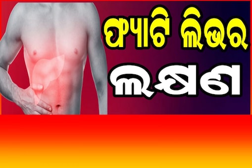 ଫ୍ୟାଟି ଲିଭର ସମସ୍ୟାଫ୍ୟାଟି ଲିଭର ସମସ୍ୟାଫ୍ୟାଟି ଲିଭର ସମସ୍ୟା