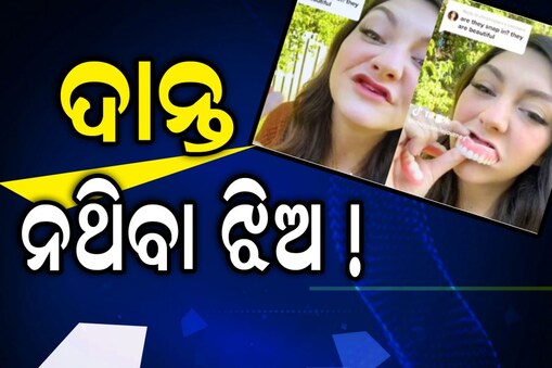 ୩୦ ବର୍ଷରେ ଏହି ଝିଅଙ୍କର ଭାଙ୍ଗିଗଲା ସବୁ ଦାନ୍ତ; କାହିଁକି ଏପରି ଘଟିଲା ଜାଣିଛନ୍ତି କି ?