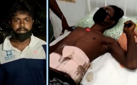 ଭୁବନେଶ୍ୱର: ଛୁରାମାଡ଼ର ଶିକାର ଯୁବକ କରୋନା ପଜିଟିଭ୍ ହେଲେ; ହସ୍ପିଟାଲରେ ହେଉନି ଚିକିତ୍ସା