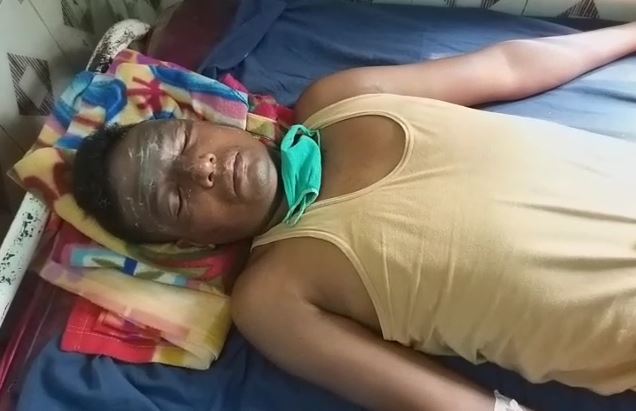  ଏହି ଯବାନଙ୍କ କପାଳରେ ନିଆଁ ଲାଗି ପୋଡ଼ିଯାଇଛି ।