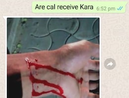 news18 - ପ୍ରେମରେ ବାଧା ଯୋଗୁଁ ହାତ କାଟିଲେ BJB କଲେଜ୍ ଛାତ୍ର; ରକ୍ତରେ ଲେଖିଲେ ପ୍ରେମିକା ନାଁ