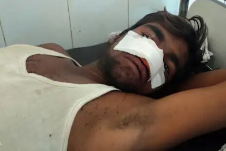 VIDEO: ଯୁବକକୁ ଘରୁ ଉଠେଇ ମଶାଣିକୁ ନେଲେ, ଗଛରେ ବାନ୍ଧି ପିଟିଲେ, ନାକ କାଟିବା ପ୍ରୟାସ କଲେ