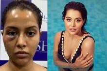 ଫେସିଆଲ୍ ଟ୍ରିଟ୍‌ମେଣ୍ଟ୍ ଏହି ଅଭିନେତ୍ରୀଙ୍କ ମୁହଁ ଖରାପ କରିଦେଲା; PICS ଶେୟାର କଲେ