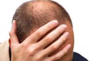 ‘ଚନ୍ଦା ମୁଣ୍ଡର ପୁରୁଷମାନଙ୍କଠାରେ କରୋନା ସଂକ୍ରମିତ ହେବା ପରେ ମୃତ୍ୟୁ ସମ୍ଭାବନା ବେଶୀ’