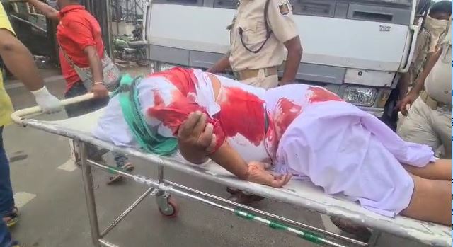  ଗ୍ୟାଙ୍ଗଷ୍ଟର୍‌ ଶେଖ୍‌ ହାଇଦର୍‌ ଅଲି ଦେହରେ ଜୁଲାଇ ୨୪, ୨୦୨୧ ଅପରାହ୍ଣରେ ପୋଲିସର ଗୁଳି ଲାଗିବା ପରେ ତାକୁ ବାଲେଶ୍ୱର ସଦର ହସପିଟାଲରେ ଭର୍ତ୍ତି କରାଯାଇଥିଲା । ସେଇଠି ସେ ପ୍ରାଣ ହରାଇଥିଲା ।