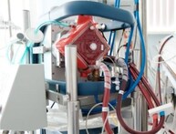 ରାଜ୍ୟର ହସପିଟାଲଗୁଡ଼ିକରେ ସ୍ଥାପନ ହେଲା ୯ଟି ଏକମୋ ମେସିନ୍; ଅଗଷ୍ଟ ୧୫ରୁ କାମ କରିବ