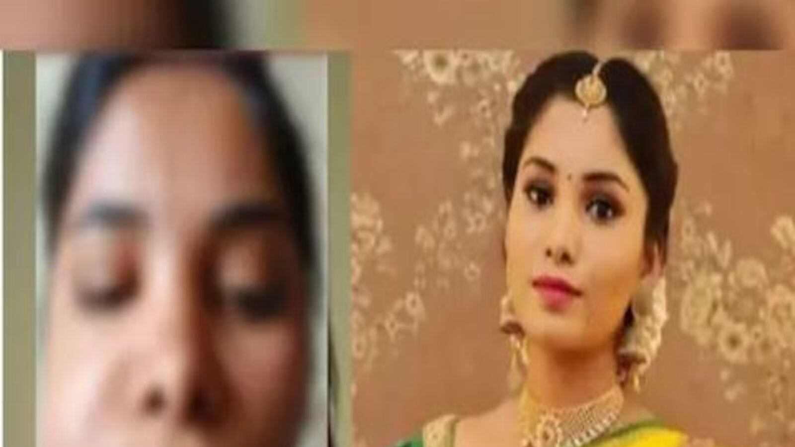 ଭୁଲ ସର୍ଜରୀ ପାଇଁ ଅସୁନ୍ଦର ହୋଇଗଲା କନ୍ନଡ ଅଭିନେତ୍ରୀ ସ୍ବାତୀ ସତୀଶଙ୍କ ଚେହେରା