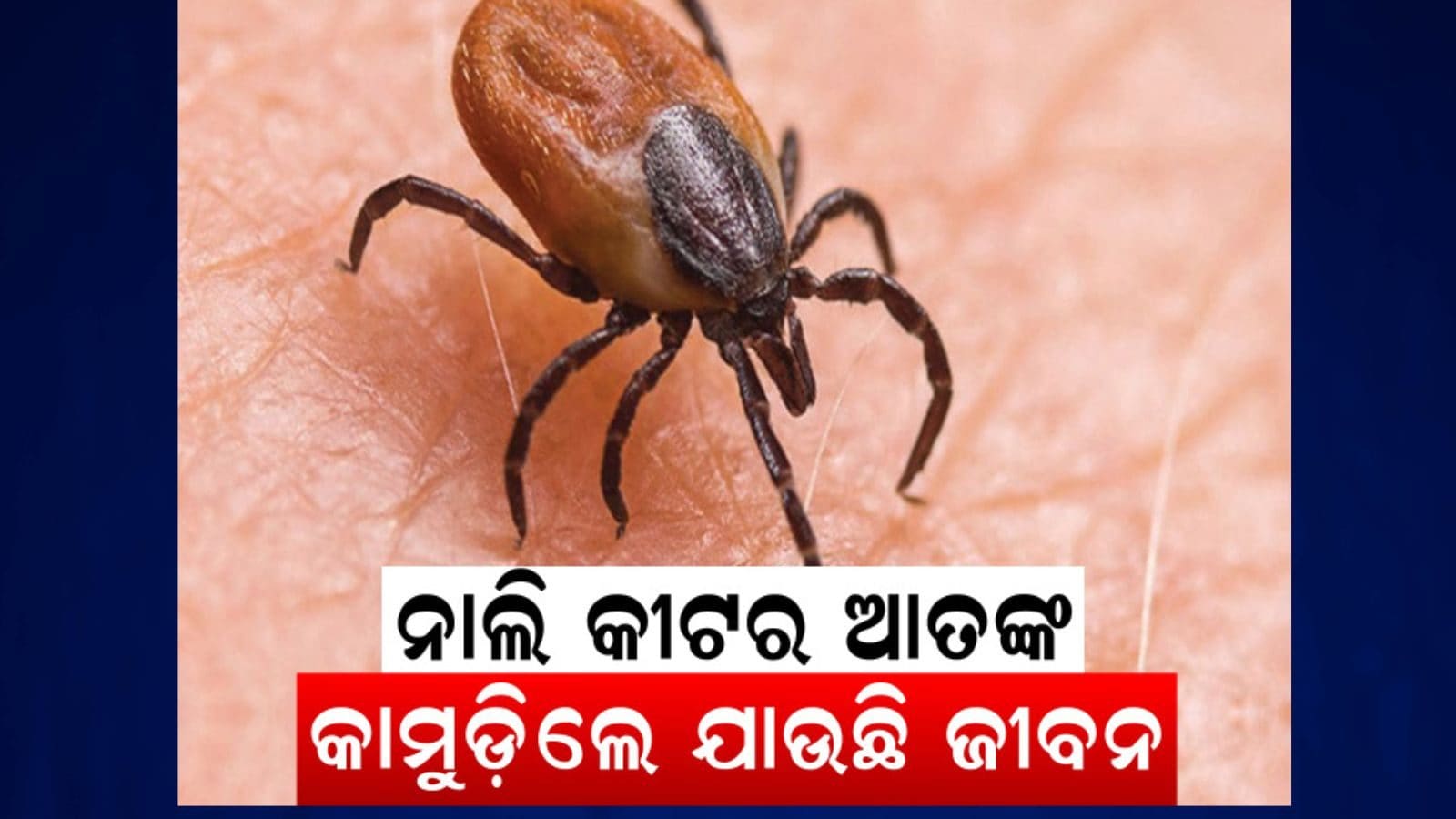 Scrub Typhus ବଢୁଛି ସ୍କ୍ରବ୍ ଟାଇଫସ୍ ମାମଲା; ଚିକିତ୍ସା ଓ ଲକ୍ଷଣ ବାବଦରେ