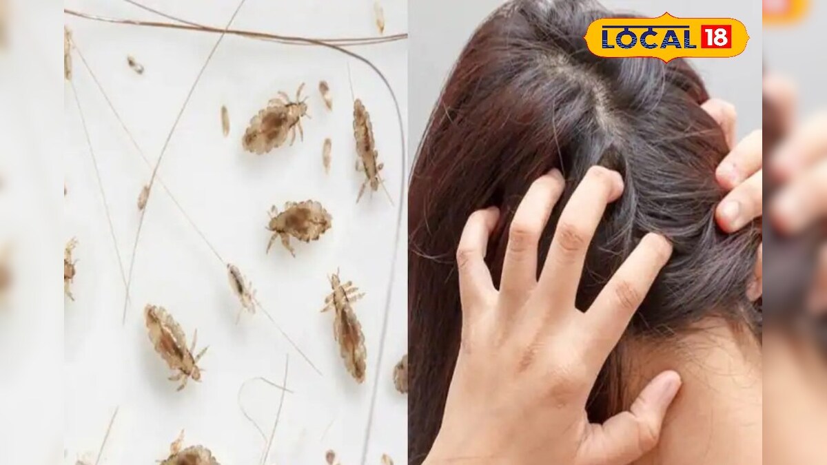 Jajpurମୁଣ୍ଡରେ ଉକୁଣୀ ହେଉଥିଲେ ସାବଧାନ ! What to do if you have lice
