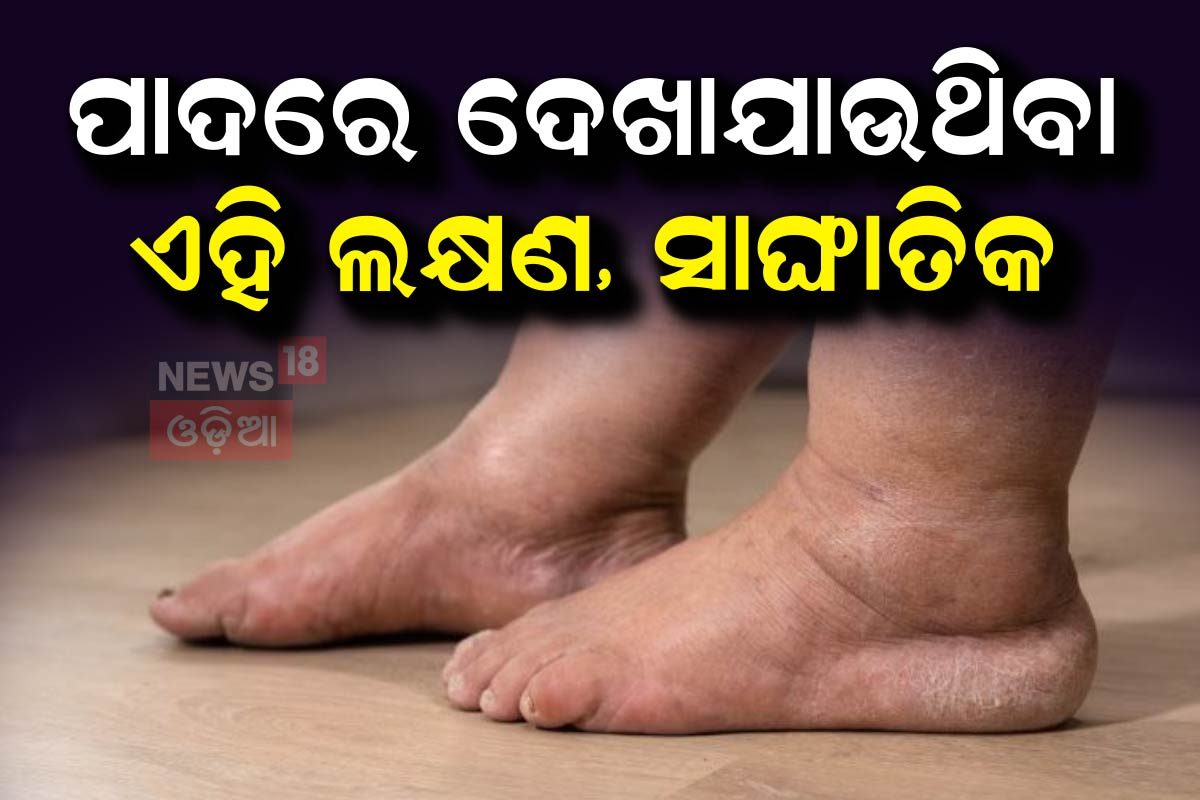 Feet Signs: ପାଦରେ ଦେଖାଯାଉଥିବା ଏହି ଲକ୍ଷଣ, ସାଙ୍ଘାତିକ ରୋଗର ସଙ୍କେତ... These ...