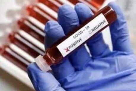 Coronavirus update: ਪੰਜਾਬ 'ਚ ਅੱਜ 930 ਨਵੇਂ ਕੋਰੋਨਾ ਮਰੀਜ਼, 29 ਲੋਕਾਂ ਦੀ ਗਈ ਜਾਨ