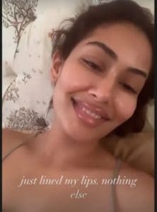 Shahid Kapoor's wife Meera Rajput's bad condition on her lips, you too will be surprised