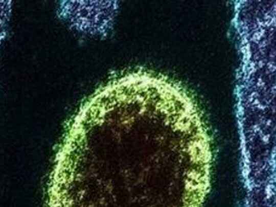 ਚੀਨ ਵਿੱਚ ਮਿਲਿਆ Zoonotic Langya Virus, ਜਾਨਵਰਾਂ ਤੋਂ ਮਨੁੱਖਾਂ ਵਿੱਚ ਹੋ ਸਕਦਾ ਹੈ ਸੰਚਾਰਿਤ
