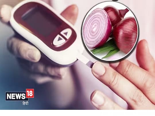 Onion May Reduce Blood Sugar