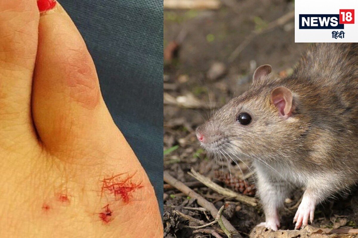 ਕੀ ਚੂਹੇ ਦੇ ਕੱਟਣ ਨਾਲ ਹੋ ਸਕਦਾ ਹੈ ਰੇਬੀਜ਼? ਜਾਣੋ ਕੀ ਕਹਿੰਦੇ ਹਨ ਸਿਹਤ ਮੰਤਰਾਲੇ ...