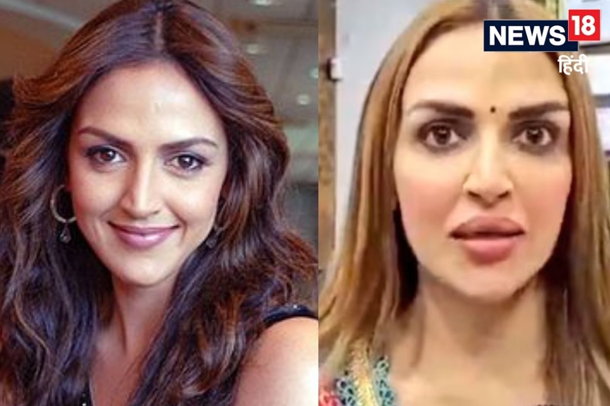 Esha Deol ਨੇ ਕਾਰਵਾਈ Lip ਸਰਜਰੀ! ਉਸ ਸਮੇਂ ਦੀਆਂ ਅਤੇ ਹੁਣ ਦੀਆਂ ਤਸਵੀਰਾਂ ਹੋਈਆਂ ...