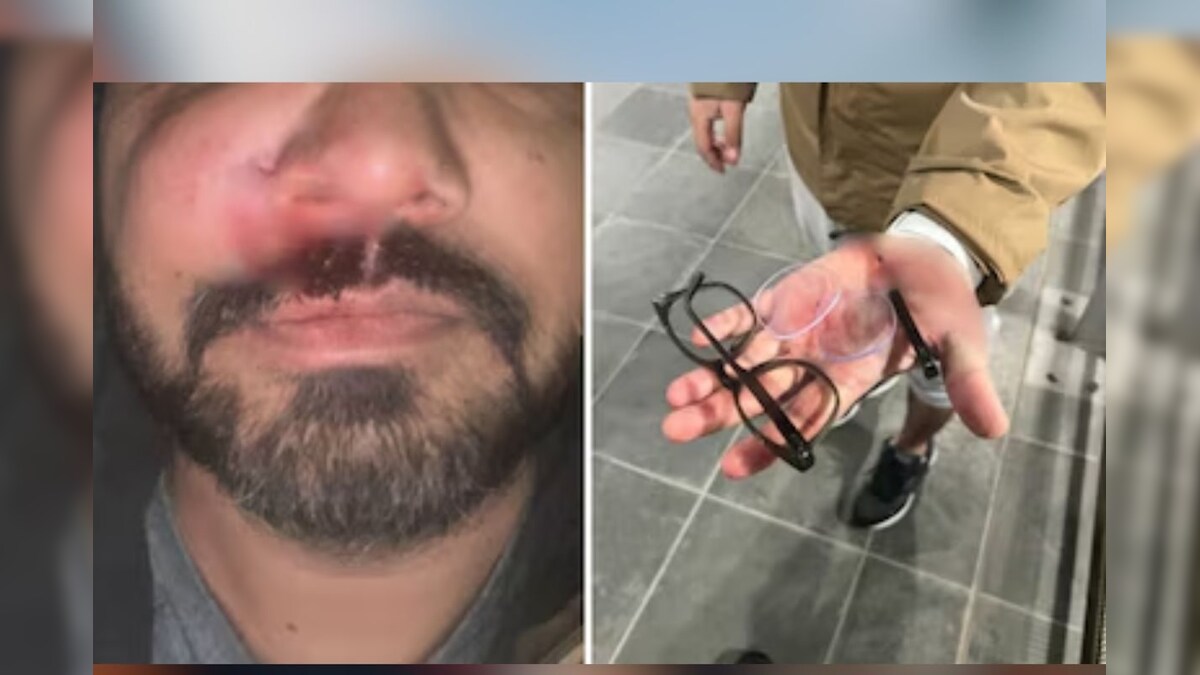 The glasses were deeply, the mouths broke … ethnic attack in Ireland, the gang in Ireland, beat the Indian