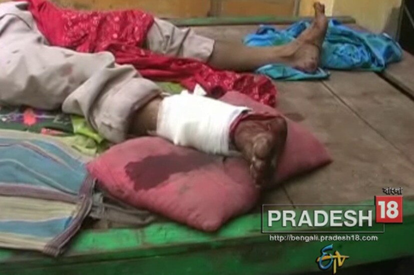কেতুগ্রামে আহত ব্যক্তির চলছে প্রাথমিক চিকিৎসা ৷ নির্বাচন কমিশনের কাছে জমা পড়েছে অভিযোগ ৷ 