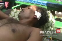 কেতুগ্রামে সিপিআইএম সমর্থকের কাটা গেল কান ! দেখুন ছবি কেতুগ্রামে সিপিআইএম সমর্থকের কাটা গেল কান ! দেখুন ছবি