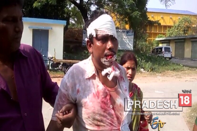 চাকদহ কলেজে ভোট দিতে যাচ্ছিলেন সিপিআইএম কর্মী সমীর দেবনাথ ৷ ভোট দিতে যাওয়ার পথে মারধর করা হয় তাঁকে ৷ তৃণমূলের বিরুদ্ধে মারধরের অভিযোগ ৷ 