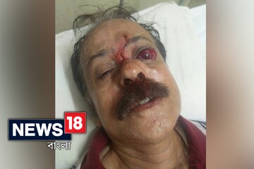 নবান্ন অভিযান ঘিরে ধুন্ধমার, পুলিশের লাঠির ঘায়ে আহত কান্তি গাঙ্গুলি সহ ১০০-এরও বেশি বাম সমর্থক
