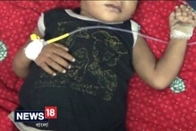 সফল পুরুলিয়ার সুচবিদ্ধ শিশুর অস্ত্রোপচার, ৪৮ ঘণ্টা রাখা হয়েছে পর্যবেক্ষণে সফল পুরুলিয়ার সুচবিদ্ধ শিশুর অস্ত্রোপচার, ৪৮ ঘণ্টা রাখা হয়েছে পর্যবেক্ষণে