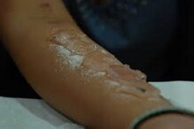 ব্লু হোয়েলের পর এবার হাজির নতুন ‘সুইসাইড’ গেম সল্ট অ্যান্ড আইস ব্লু হোয়েলের পর এবার হাজির নতুন ‘সুইসাইড’ গেম সল্ট অ্যান্ড আইস