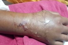 ডেবরায় ফের ট্যারেন্টুলার আতঙ্ক, বিষাক্ত মাকড়সার কামড়ে গুরুতর অসুস্থ অন্তঃসত্ত্বা ডেবরায় ফের ট্যারেন্টুলার আতঙ্ক, বিষাক্ত মাকড়সার কামড়ে গুরুতর অসুস্থ অন্তঃসত্ত্বা