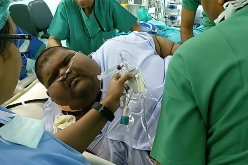 মিহির বিশ্বের সবচেয়ে বেশি ওজনের কিশোর বলে মনে করা হচ্ছে।  বডি মাস ইনডেক্স ছিল ৯২ কেজি  (Photo collected)