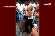 টাকা চুরির অপবাদে ৭ বছরের শিশুকে অমানবিক অত্যাচার, দেখুন সেই ভয়ঙ্কর ছবি টাকা চুরির অপবাদে ৭ বছরের শিশুকে অমানবিক অত্যাচার, দেখুন সেই ভয়ঙ্কর ছবি