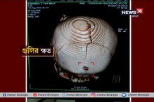গুলির আঘাত কাটিয়ে চিকিৎসায় সাড়া দিচ্ছে ৩ বছরের মৃণাল, আশায় পরিবার গুলির আঘাত কাটিয়ে চিকিৎসায় সাড়া দিচ্ছে ৩ বছরের মৃণাল, আশায় পরিবার