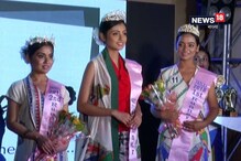 অ্যাসিডে মুখ পুড়েছে, মনের জোর নয় অ্যাসিডে মুখ পুড়েছে, মনের জোর নয়
