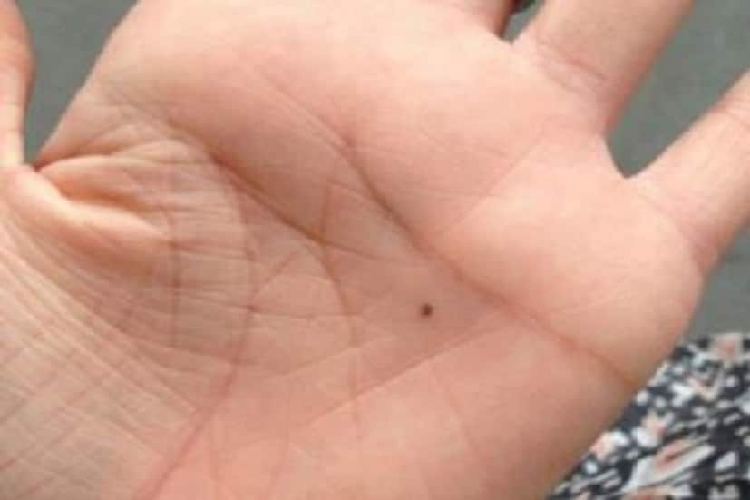 হাতে তিল : জাতক-জাতিকার হাতের কোনও আঙুলে তিল থাকা মানে তাঁকে সহজে বিশ্বাস করা উচিত নয় ৷ হাতের ফাঁকে তিল থাকা অর্থাৎ খারাপ ভাগ্যর সঙ্গে অনেক প্রতিবন্ধকতার শিকার ৷ ছবি সংগৃহীত ৷ 