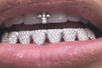 লেটেস্ট ট্রেন্ড দাঁতে হিরে ! হিট মডেলের ছবিতে মজেছে নেট দুনিয়া...