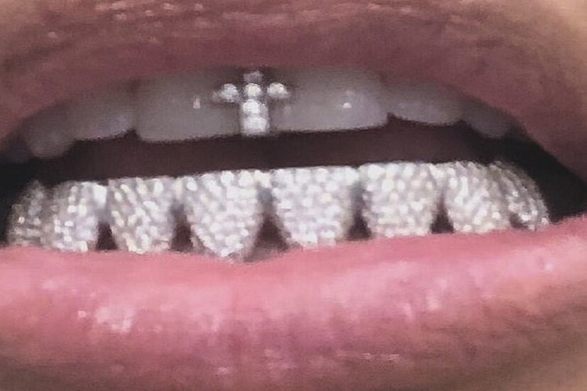 দাঁতে হিরে ! ভাবতে পারছেন ৷  এটাই লেটেস্ট ট্রেন্ড ৷ আর গলায়, হাতে, কানে নয়, এবার হিরে উঠুক দাঁতেই ৷ দাঁতেই খোদাই করে বসানো হচ্ছে এই দামি পাথর ৷ তাতেই ঘটছে শ্রীবৃদ্ধি ৷ Photo Courtesy: Instagram 