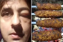 মর্মান্তিক ! সামুদ্রিক খাবার খেয়ে অসুস্থ সনু নিগম অন্যদিকে রেস্তোরাঁর খাবার খেয়ে মৃত্যু কিশোরীর মর্মান্তিক ! সামুদ্রিক খাবার খেয়ে অসুস্থ সনু নিগম অন্যদিকে রেস্তোরাঁর খাবার খেয়ে মৃত্যু কিশোরীর