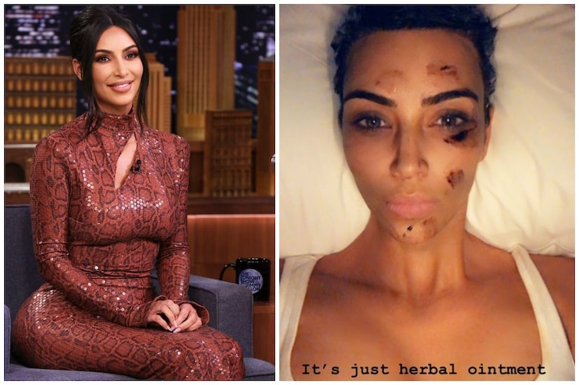 তিনি সুন্দরী, সাহসী ৷ সাধারণভাবে তার বোল্ড ছবি দেখেই অভ্যস্থ সকলে ৷ কিন্তু তার মুখে কী দেখুন ! Photo Collected 