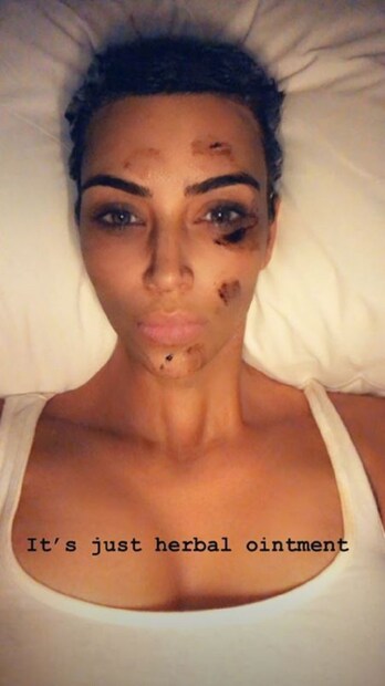 তবে মুখের চর্চা করছেন তিনি ৷ নিয়মিত সাজতে হয় তাঁকে ৷ তাই তো সোরাইসিস সারানোর চেষ্টা করছেন তিনি ৷ কিন্তু জনসমক্ষে কোনরকম এই রোগ নিয়ে গোপনীয়তা বজায় রাখছেন না ৷ Photo Courtesy: Instagram 