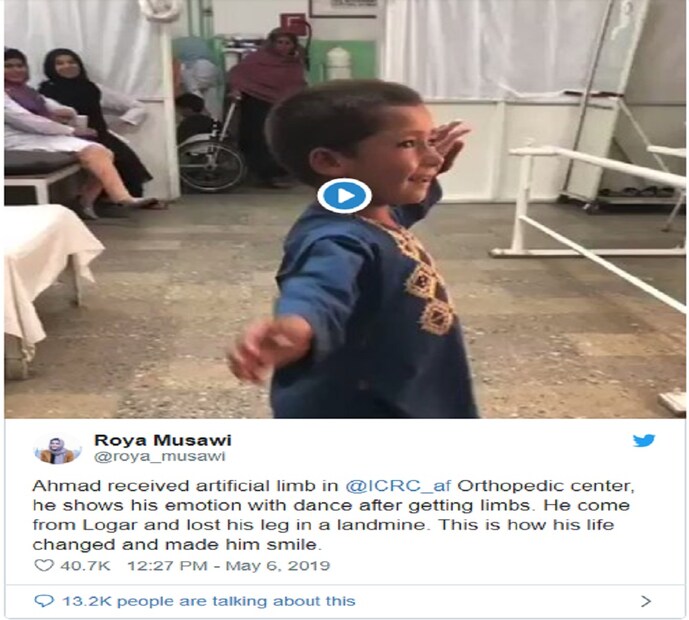 এখন কৃত্রিম পায়ের জোরে হলেও সে নিজের পায়ে দাঁড়াচ্ছে ৷ নাচগান, খোলাধূলো এটাই এখন শিশুটির জীবনের গুরুত্বপূর্ণ অঙ্গ ৷ 