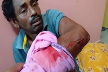 ছেলে বিজেপিকর্মী বলে মারধর বাবাকে, বাড়িতে ঢুকে প্রৌঢ়কে চপারের কোপ ছেলে বিজেপিকর্মী বলে মারধর বাবাকে, বাড়িতে ঢুকে প্রৌঢ়কে চপারের কোপ