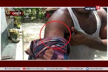 শরীরের ক্ষতচিহ্ন দেখিয়ে অভিযোগ খেজুরির বাসিন্দাদের শরীরের ক্ষতচিহ্ন দেখিয়ে অভিযোগ খেজুরির বাসিন্দাদের